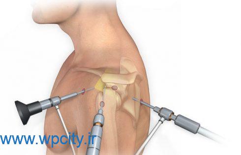 بهترین جراح شانه در تهران
